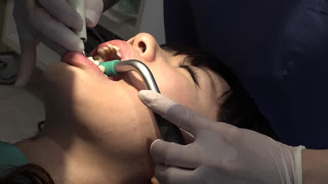 最新の技術と設備を持った… 歯フェチ！本物歯科映像 歯石除去 えみ