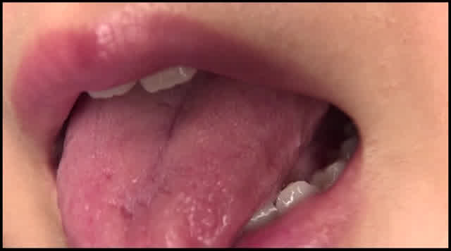 「舌、出してみて」口腔・… 口腔（2）