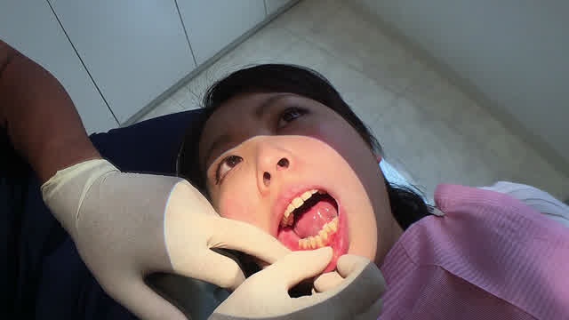 最新の技術と設備を持った… 歯フェチ！本物歯治療映像色素沈着研磨除去＆歯石除去