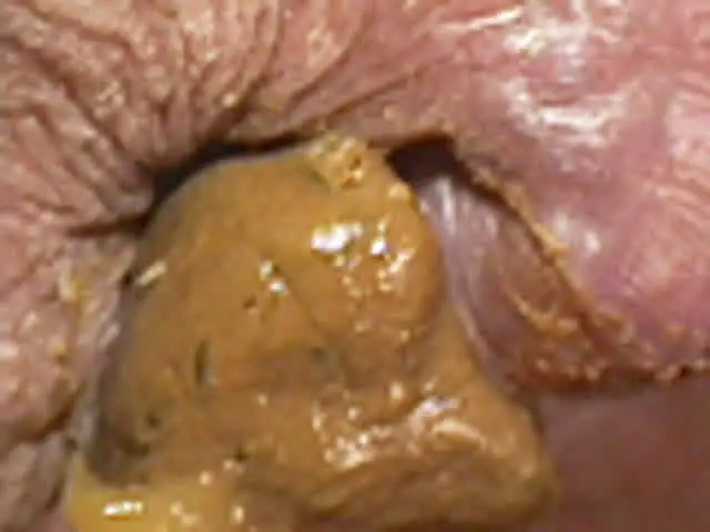 女性のアナルをしげしげと… おしりの穴 おしりの穴編