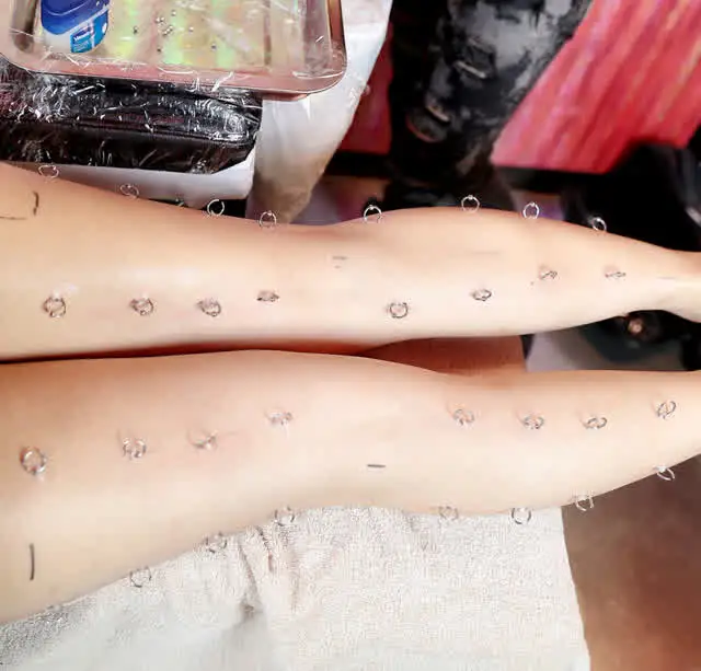 Beauty From … Beauty From Pain 施術動画